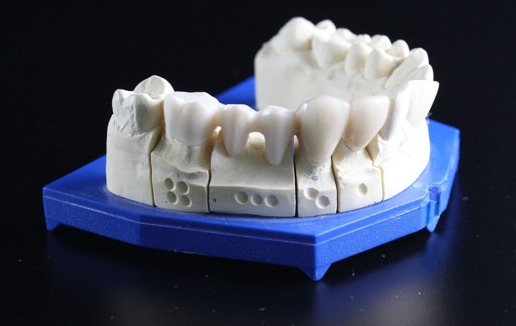 dentures, teeth, dental technician-759928.jpg