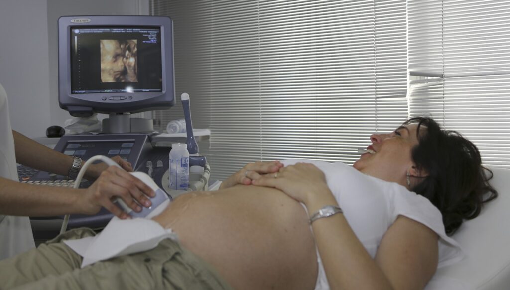 patient, ultrasound, pregnant-470514.jpg